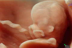 胎児ドックイメージ