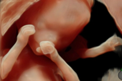 胎児ドックイメージ