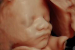 胎児ドックイメージ