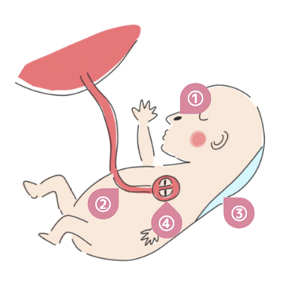 イメージ:初期胎児ドックで見ている箇所