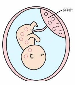 絨毛検査イメージ：正常